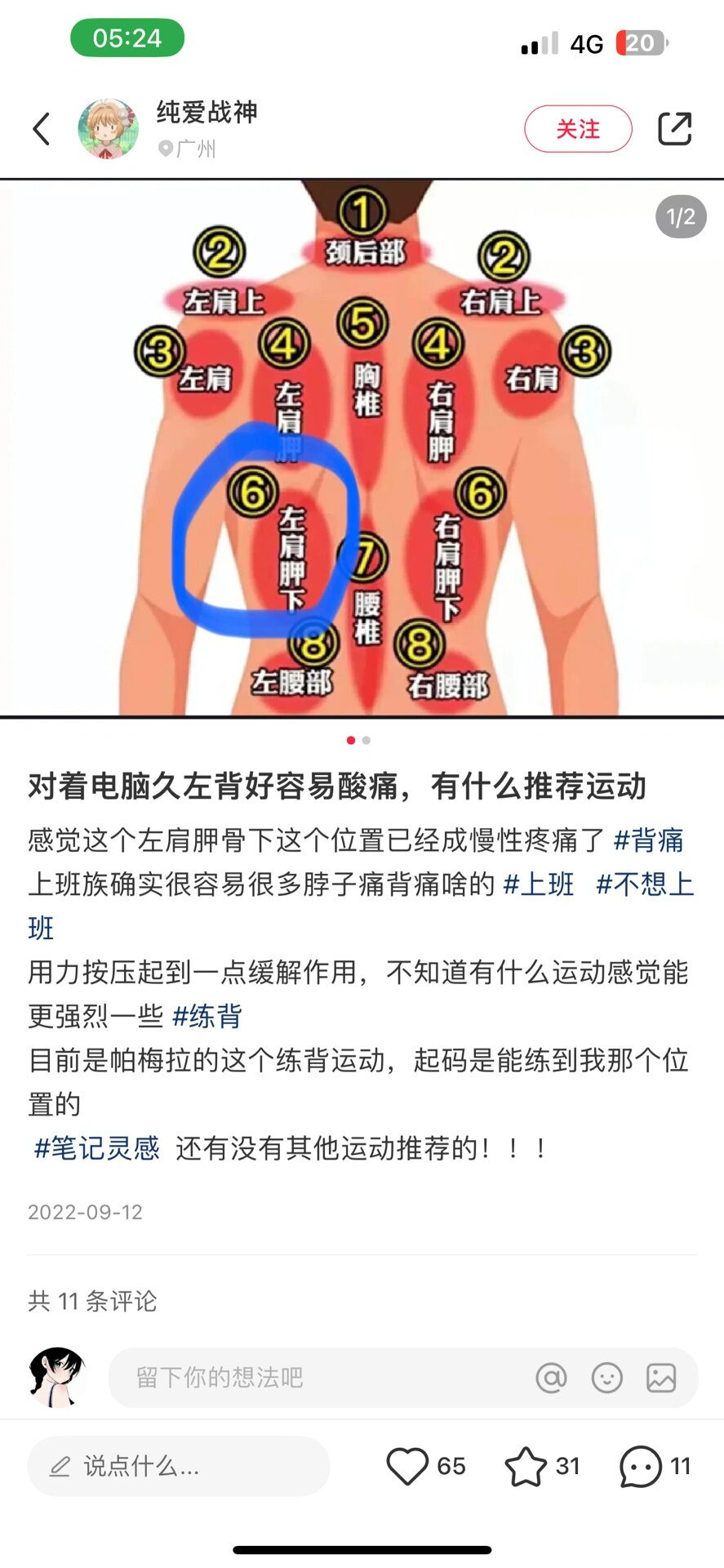 肩胛骨疼痛怎么办图片