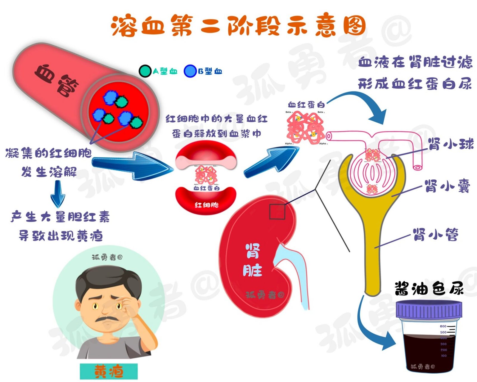 血红蛋白尿图片血尿图片