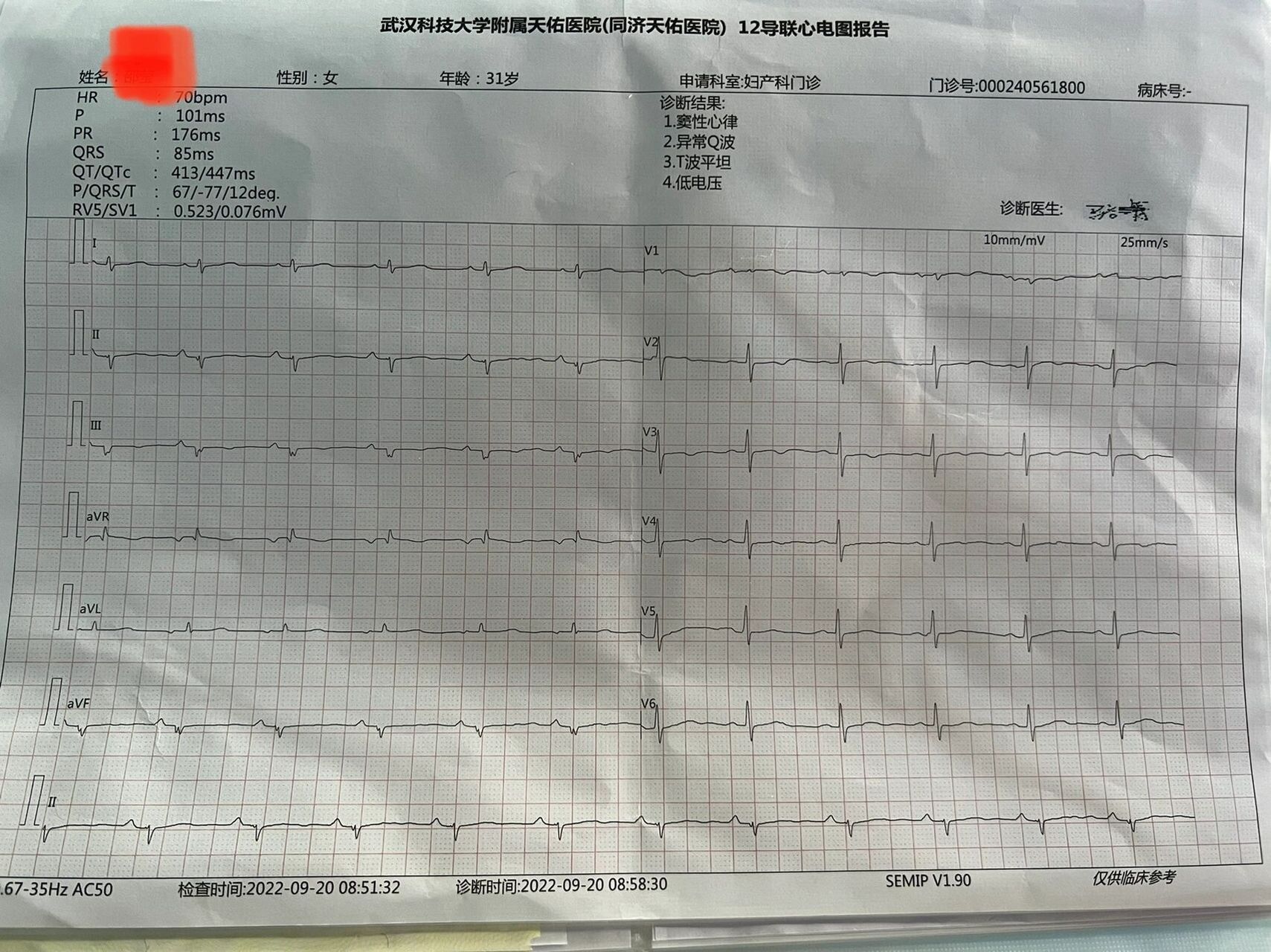 心电图报告怀孕02 怀孕11周775心电图诊断结果1.窦性心律2.