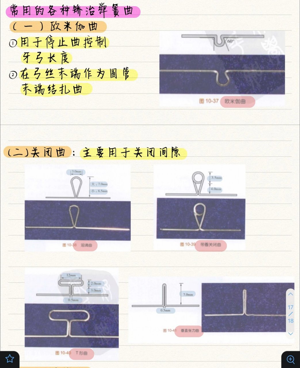 正畸垂直牵引示意图图片