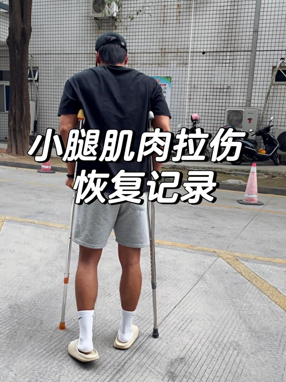 小腿肌肉拉伤恢复记录 距离上周五受伤至今,刚好一周时间,从脚掌不敢