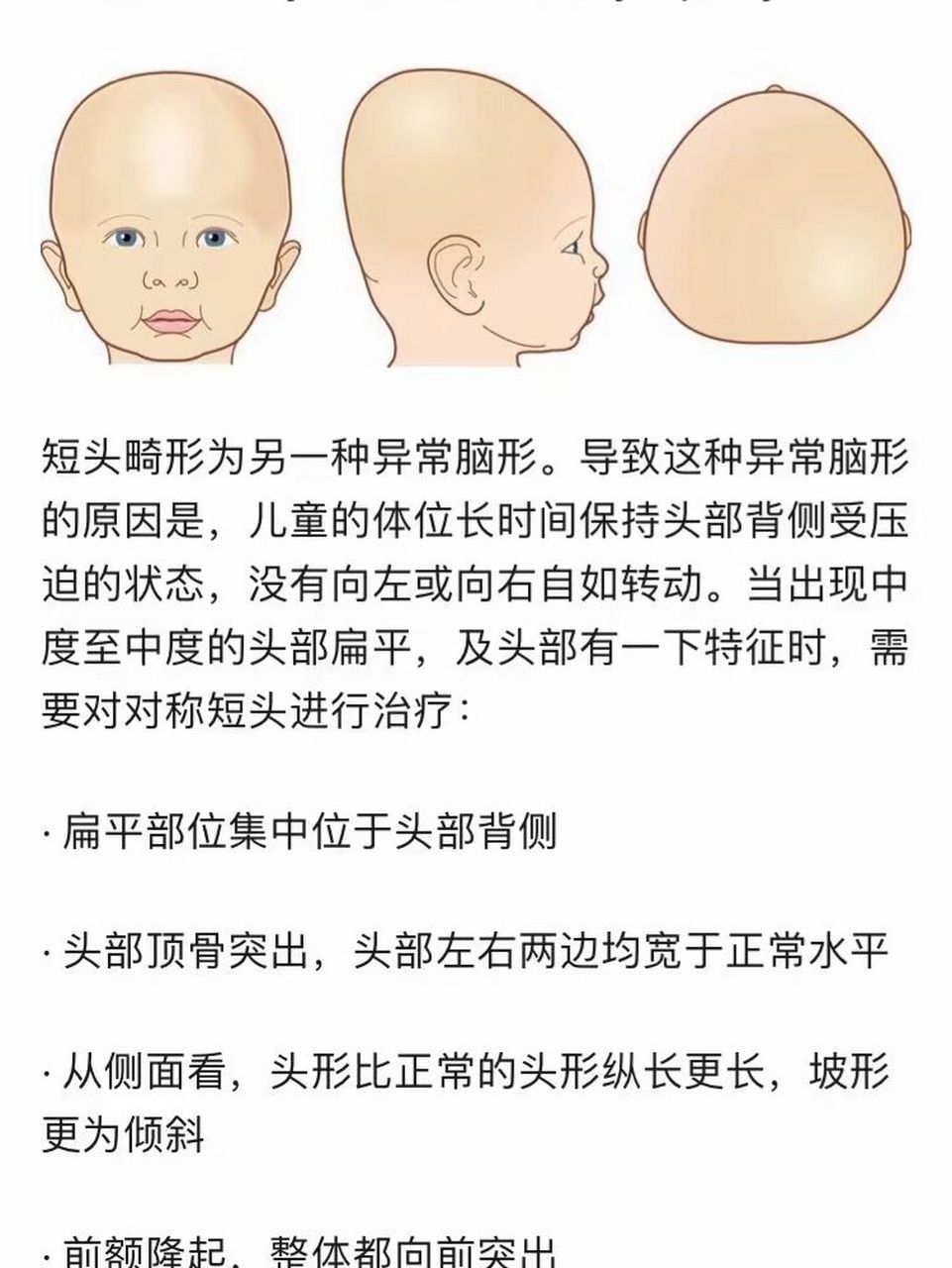 分享宝宝头颅畸形的形状 分享宝宝常见的婴幼儿头型?