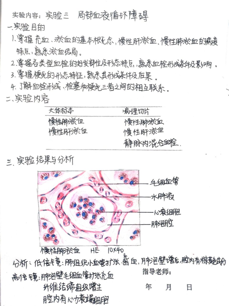 病理满分实验报告-慢性肺淤血 局部血液循环障碍 红蓝铅笔手绘 重点
