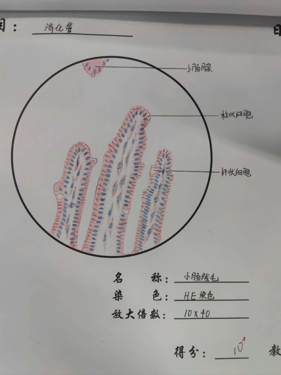 小肠绒毛结构图图片