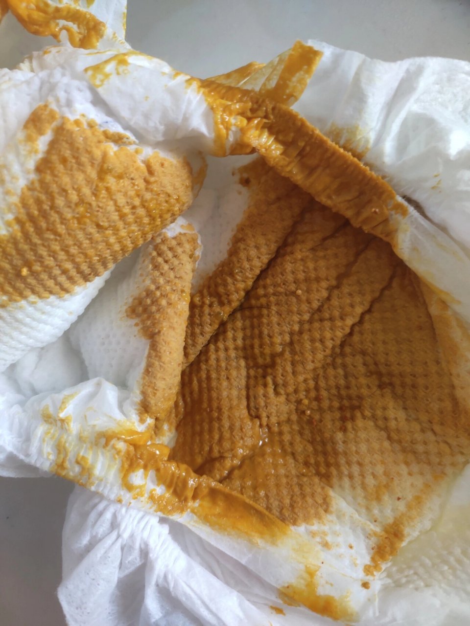 3个月宝宝水便一个月 11月17日, 一,症状: 珍妮早上6点肚子咕噜响