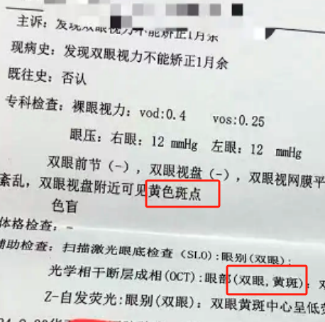 为什么眼睛突然看东西模糊