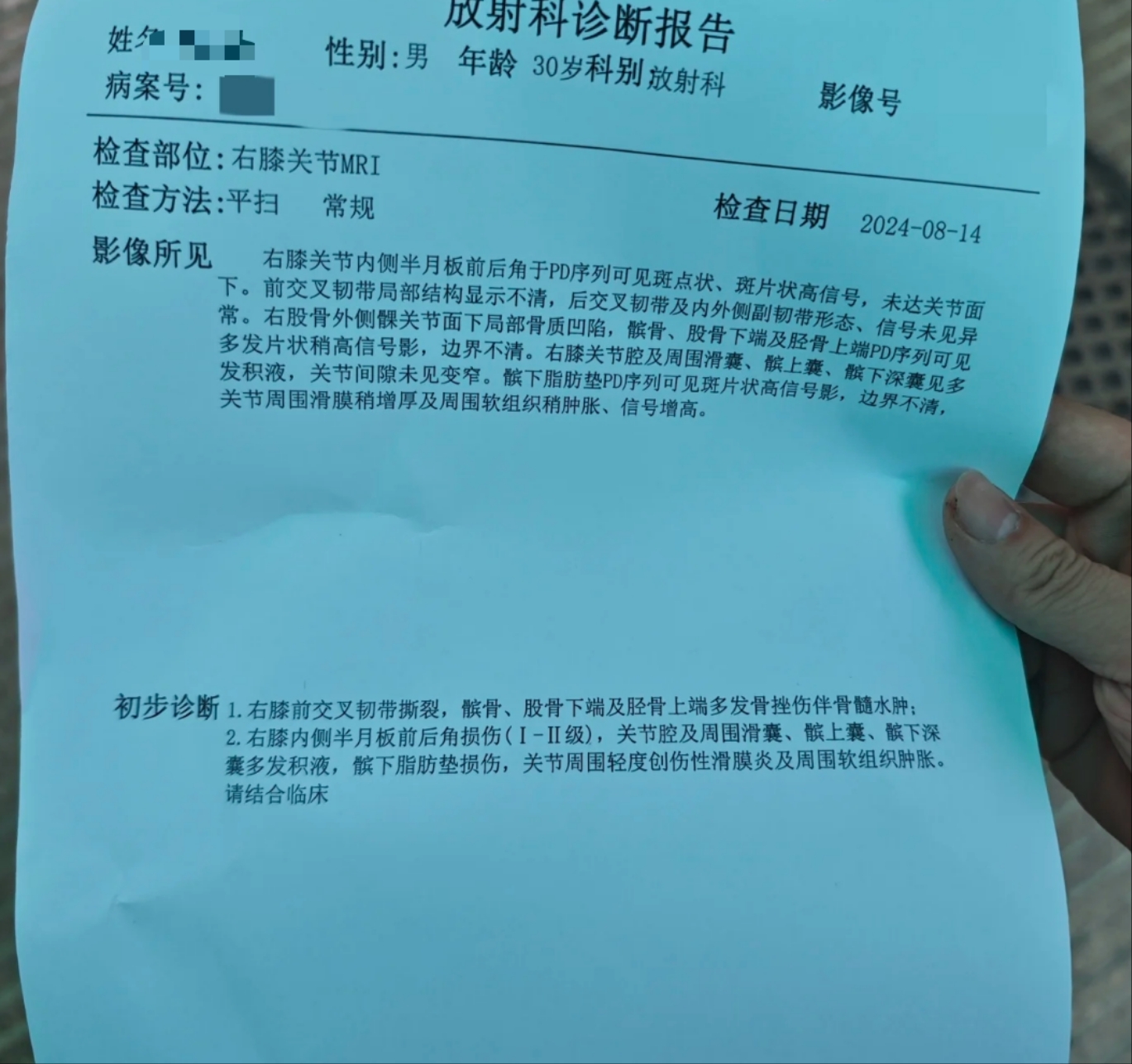 乔治韧带恢复时间(乔治伤势如何)