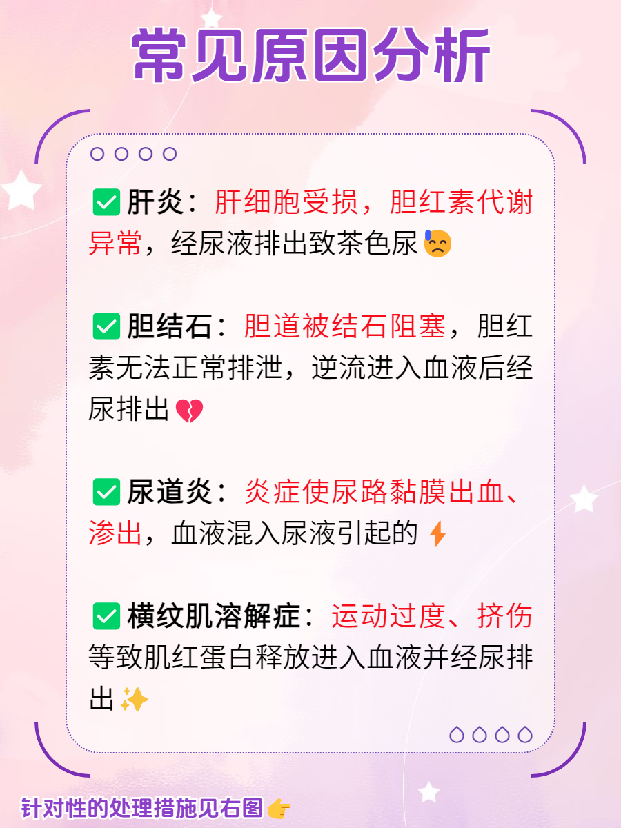 褐色尿液怎么回事晨尿茶色是什么原因茶尿色尿时怎会是茶色尿是什么