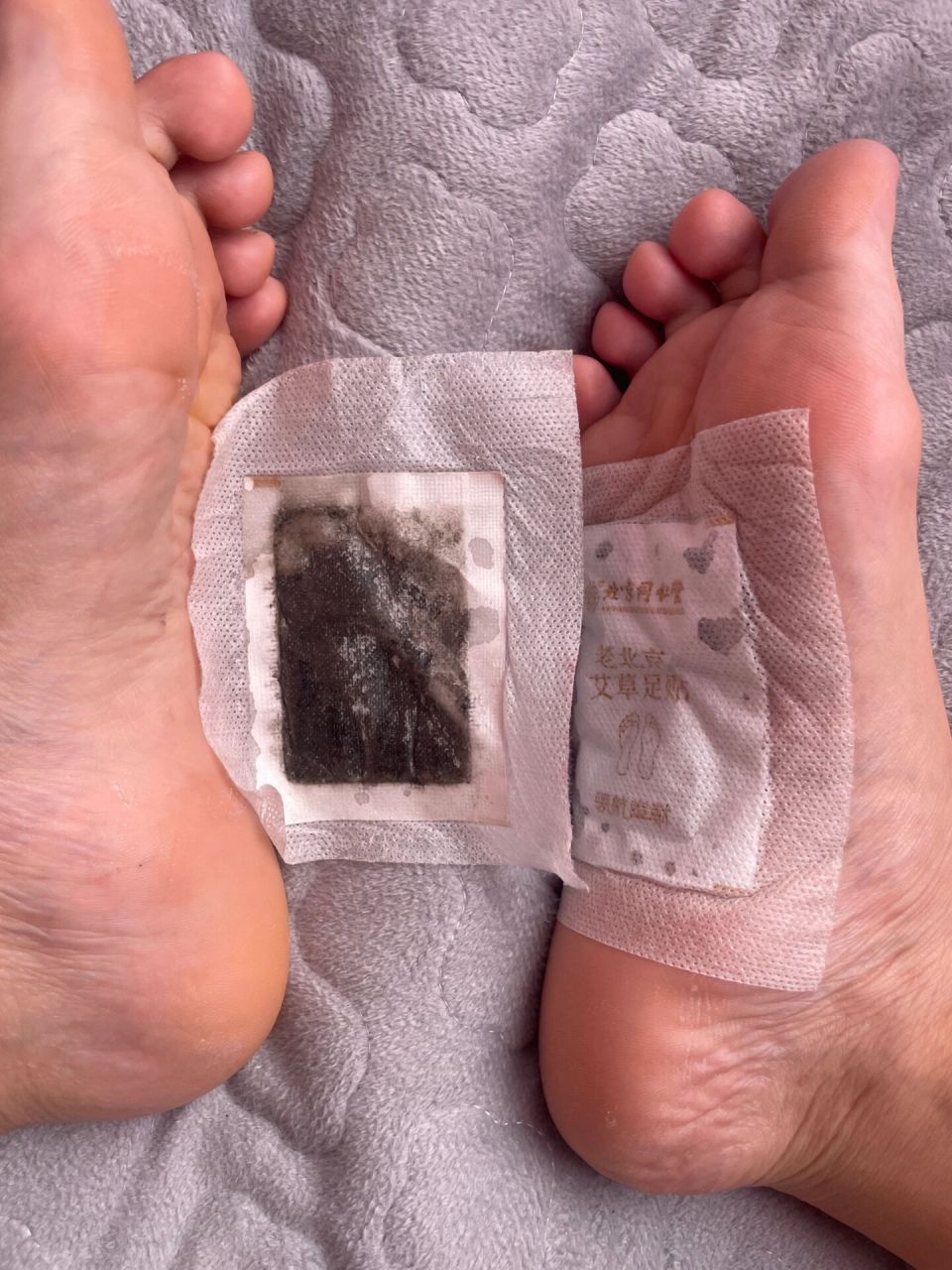 足贴祛湿 图一贴的脚底,贴上微微发热,建议睡前贴,穿袜子,不然第二天