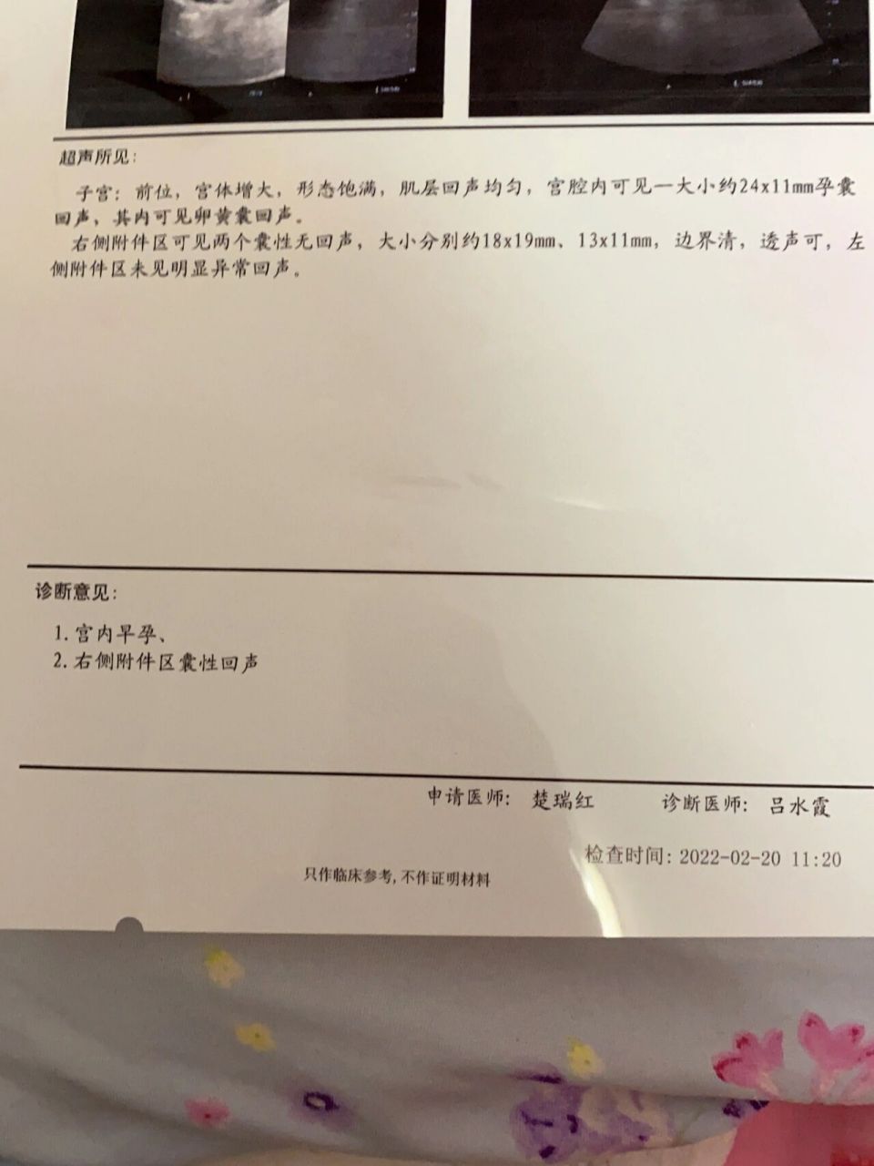 怀孕了右侧附件有两个囊肿怎么办