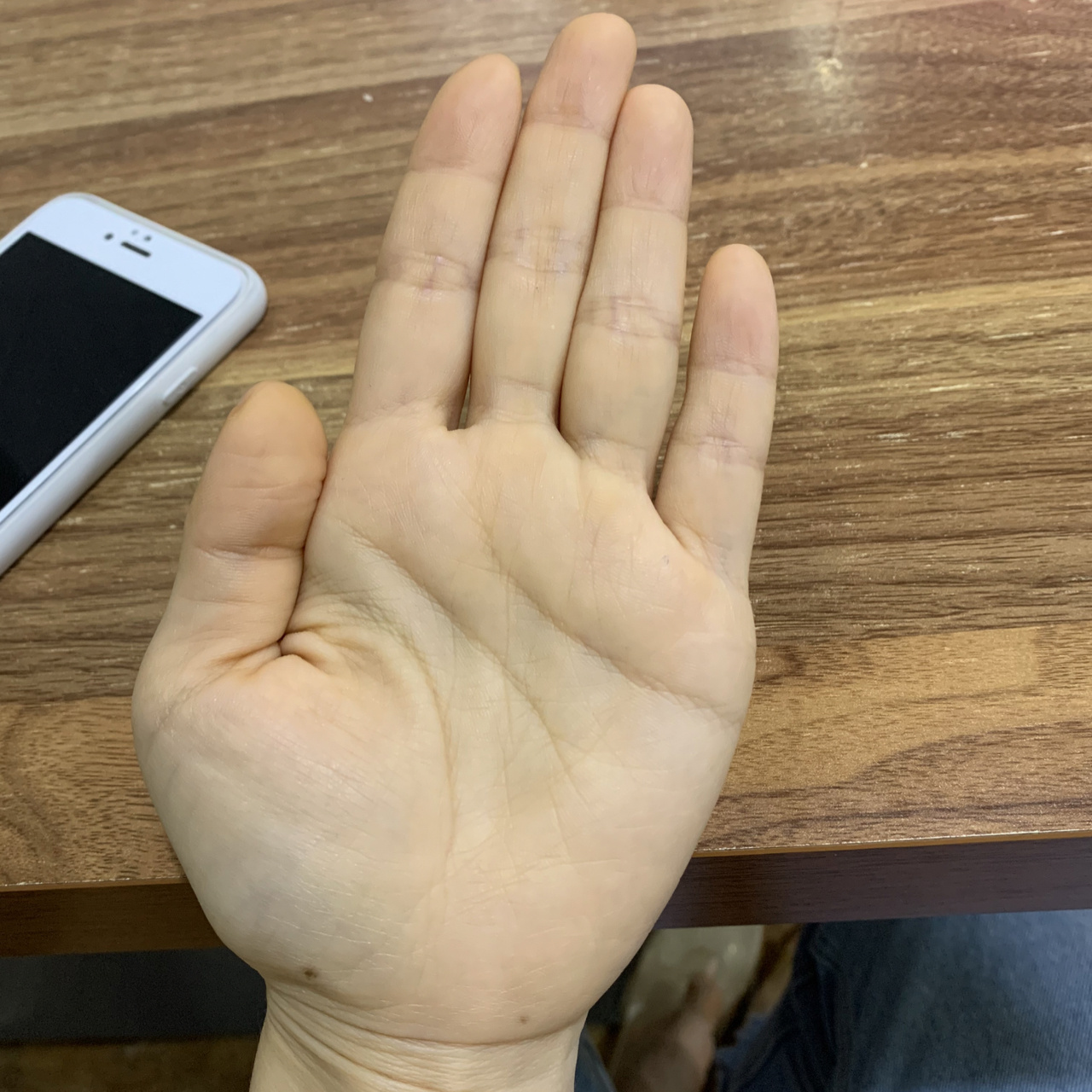 手脚发黄 不知道什么时候开始手脚板发黄……其他地方很白.