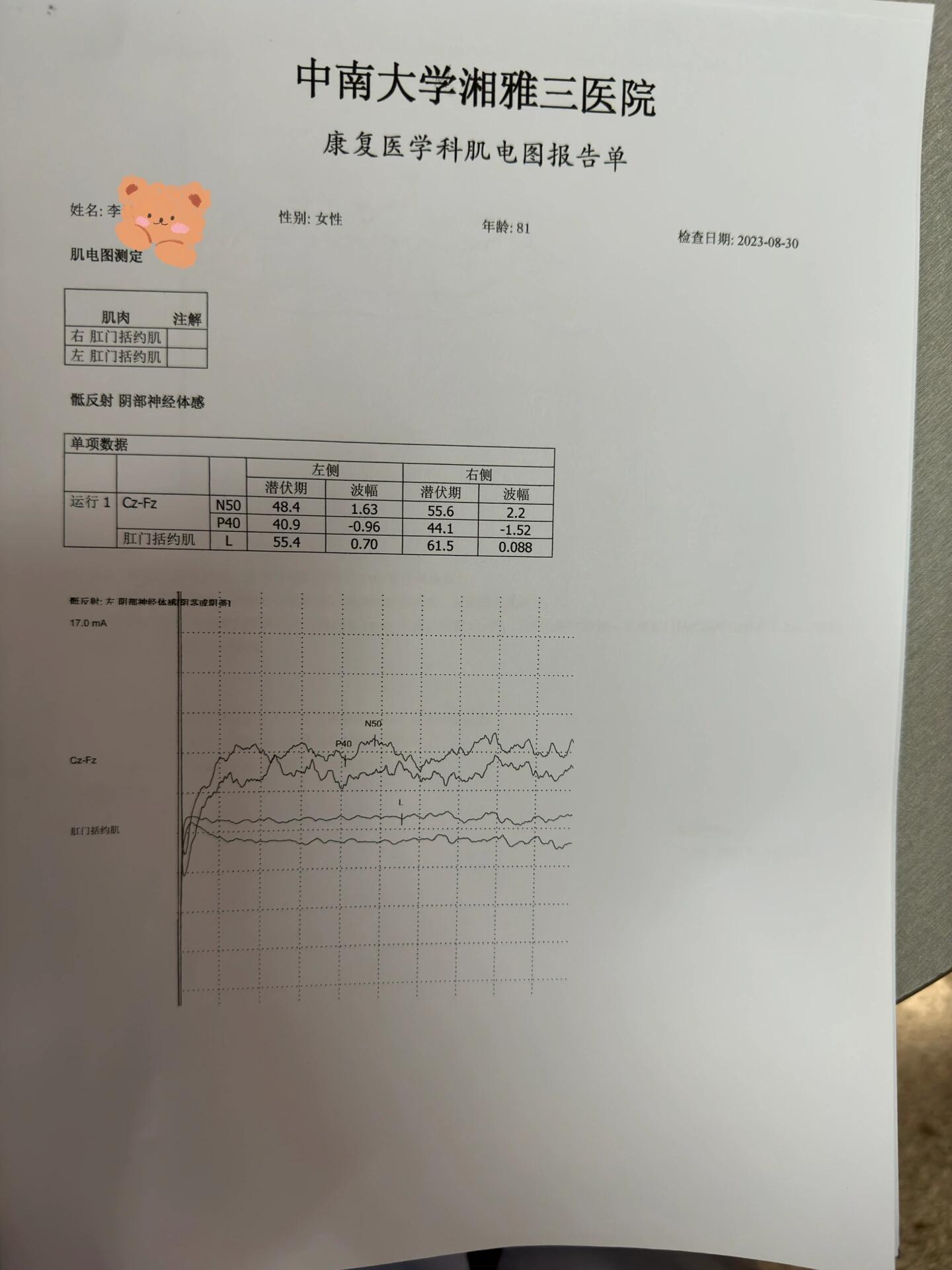 肌电图结果图片