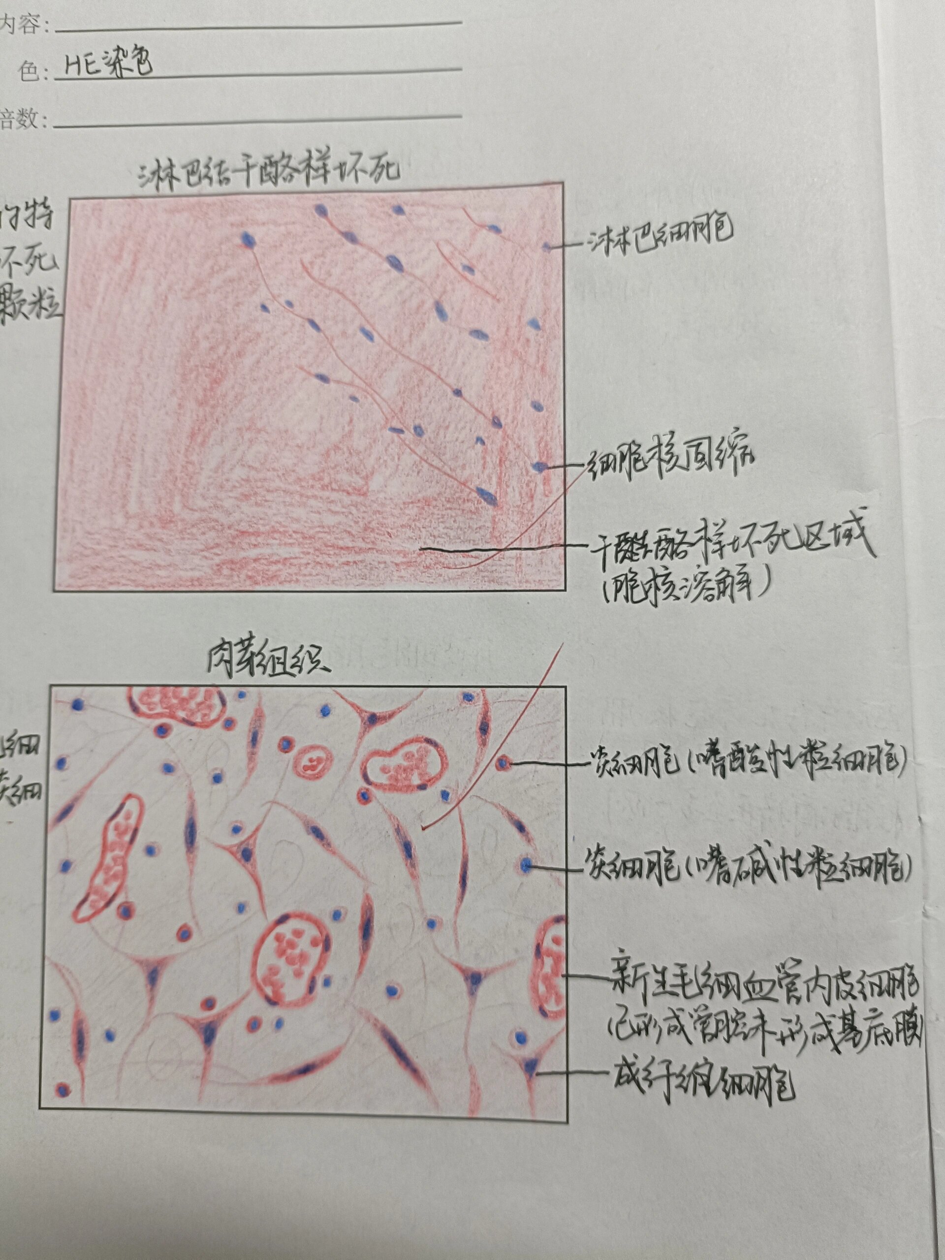 病理学红蓝铅笔绘图   p3 慢性肺淤血心衰细胞要再画大一点 p14 风湿