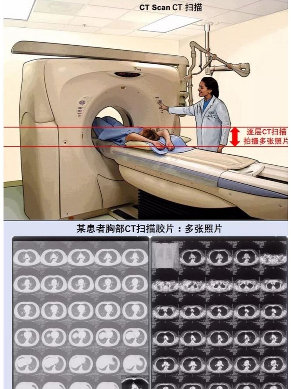 下颌骨ct平扫图片