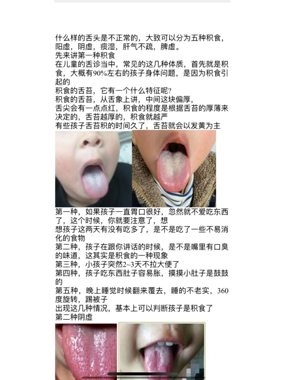 小儿积食舌苔怎么办图片