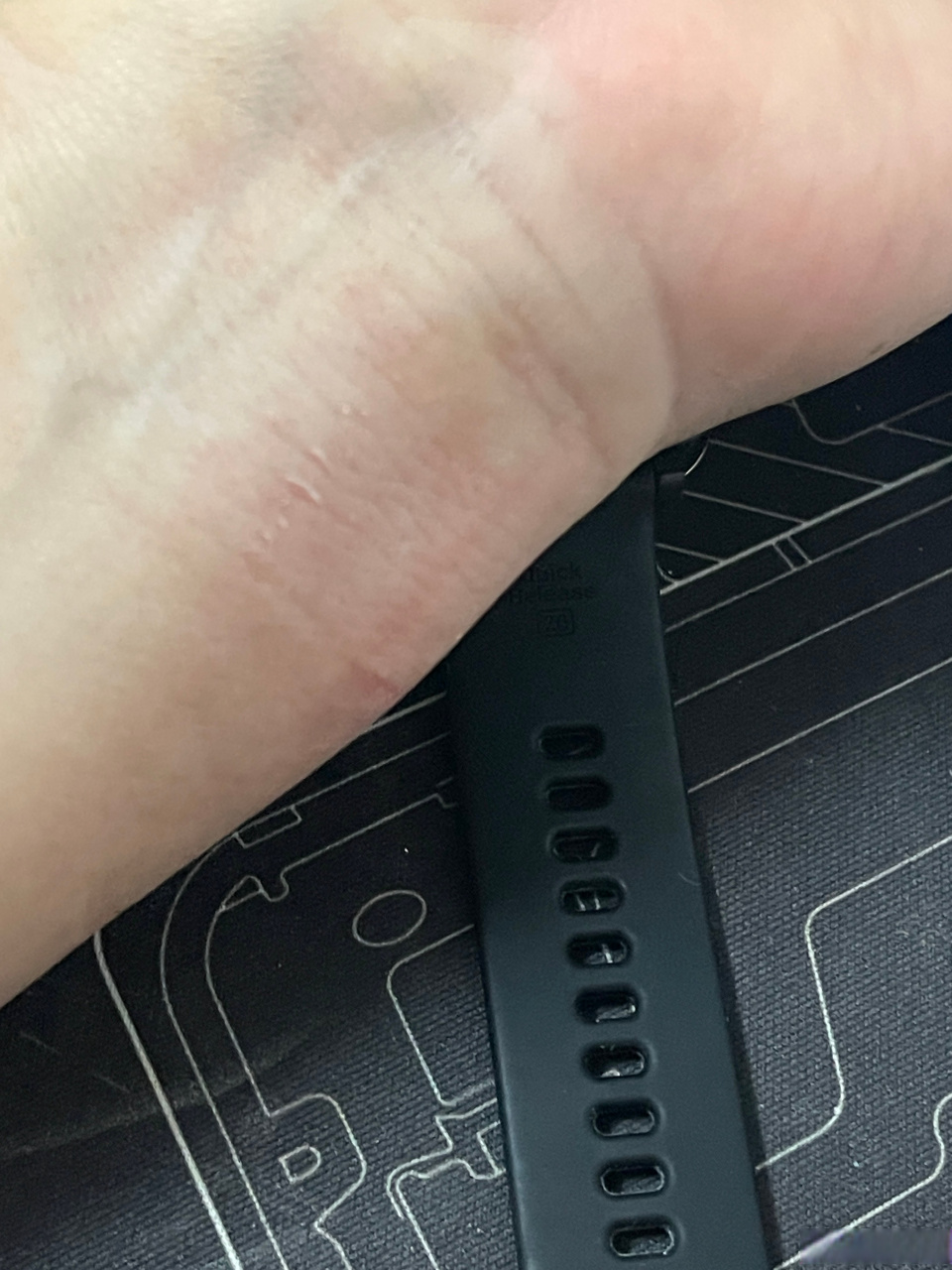 我戴智能手表,智能手环,这种表带稍微湿水就容易引起过敏,痒的厉害