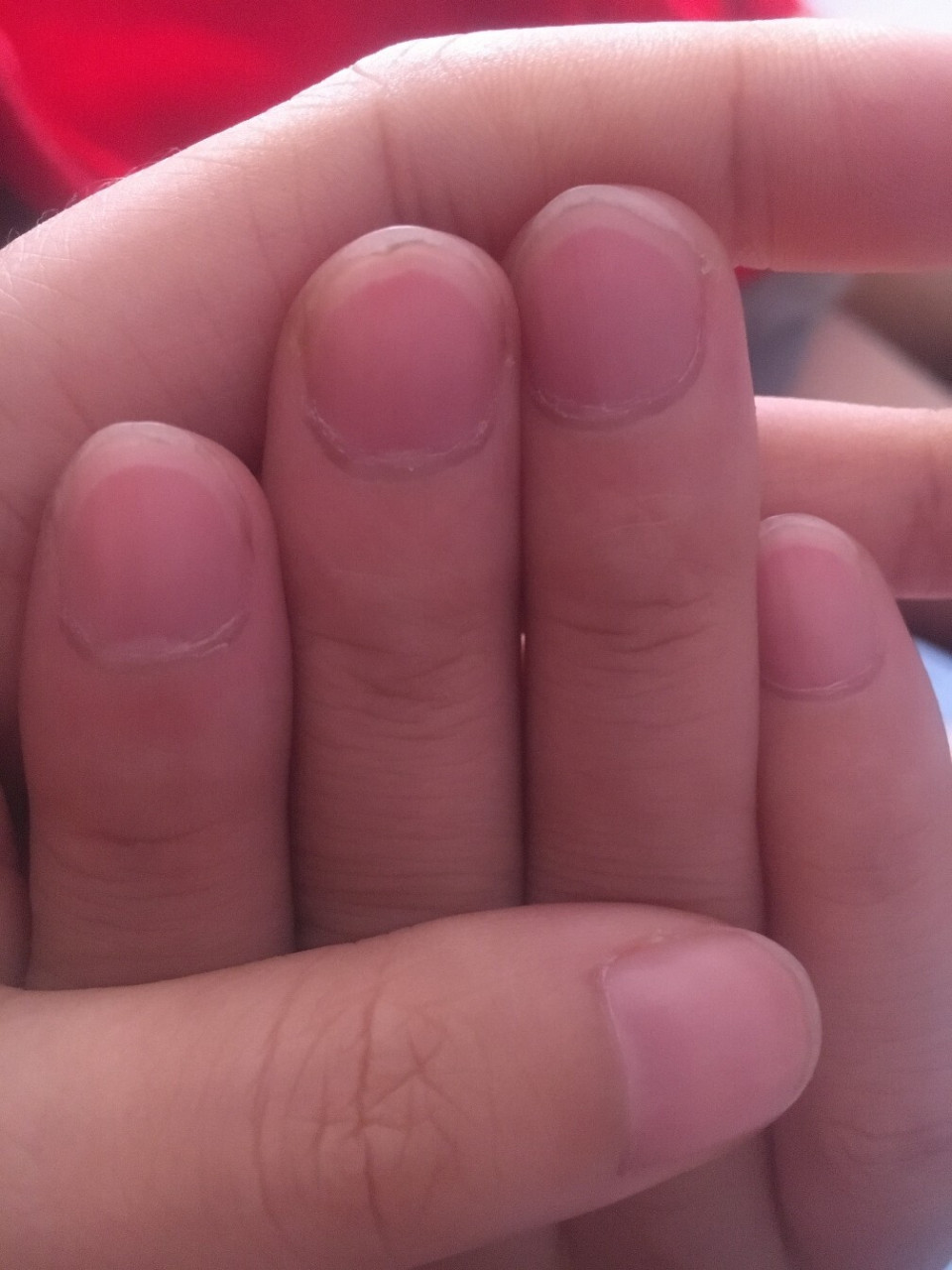 手指甲尖一圈白弧线是什么毛病? 手指甲尖一圈白弧线是什么毛病?