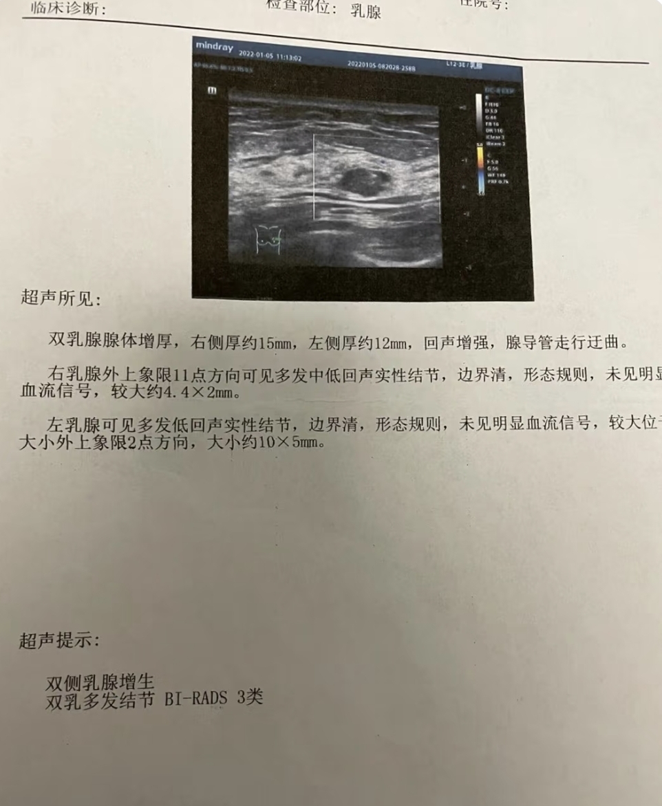 乳腺结节未见血流信号通常说明结节是良性的