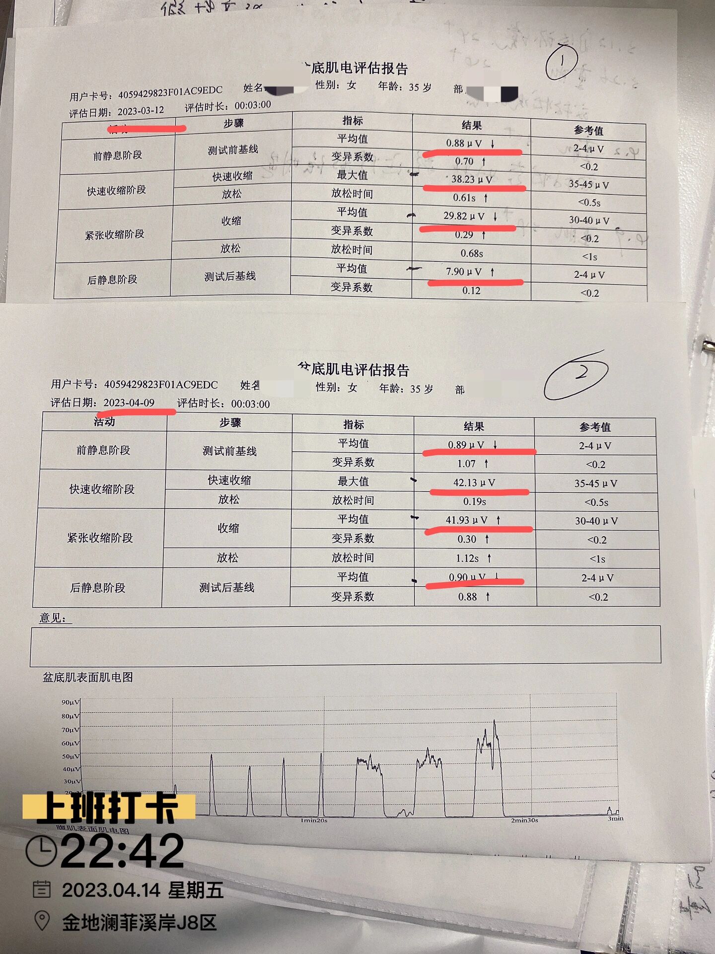 导致*交痛,便秘等 ②Ⅱ类肌(盆底肌快速收缩阶段,快肌):如果测试值