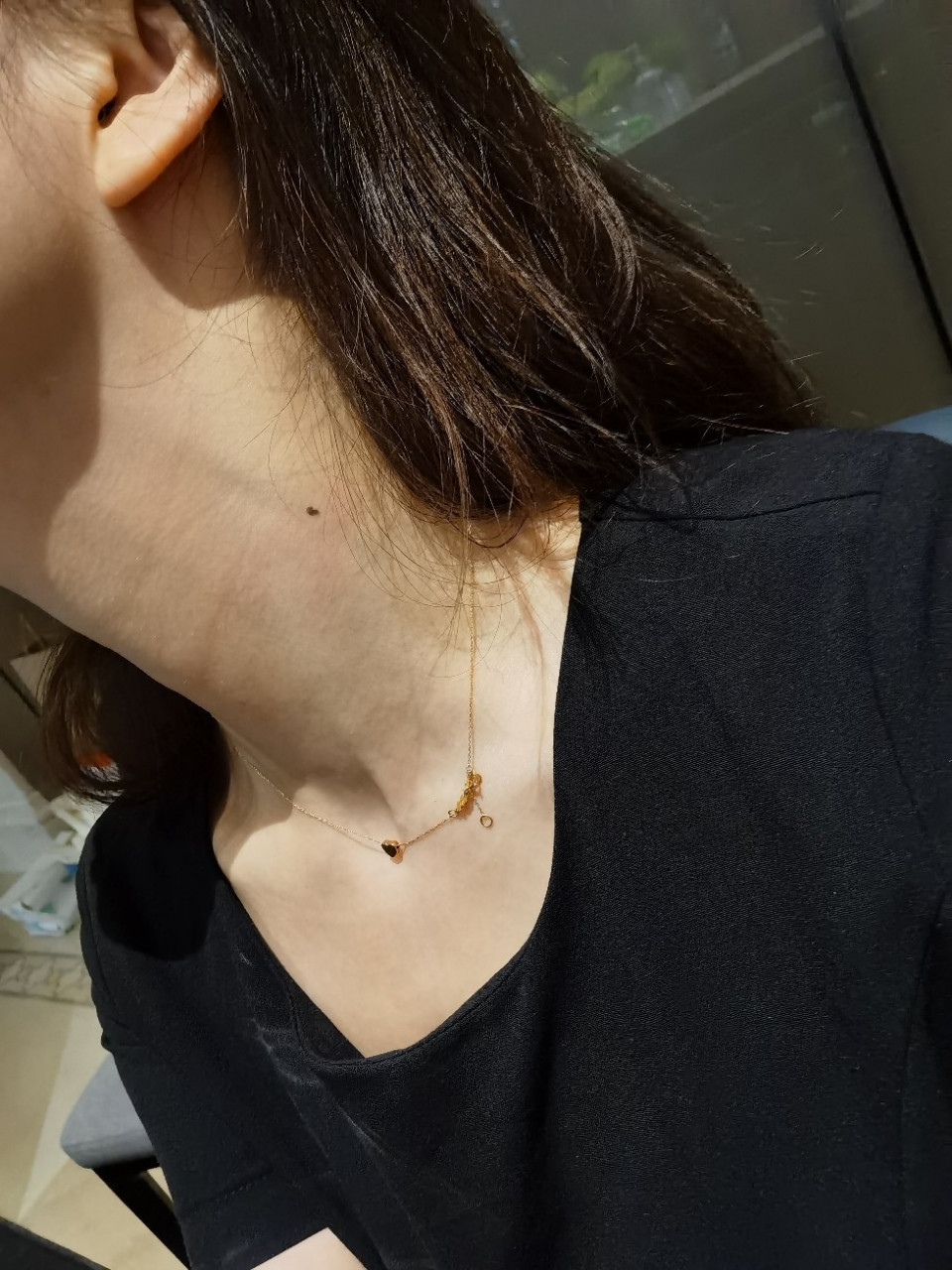 女人脖子左边的痣好吗 女人脖子左边的痣好吗