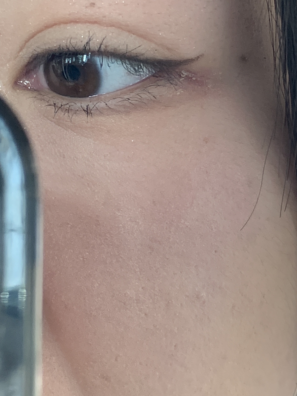 家人眼角起皮是什么情况07