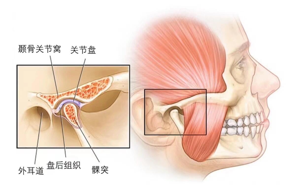 颞下颌关节位置图图片