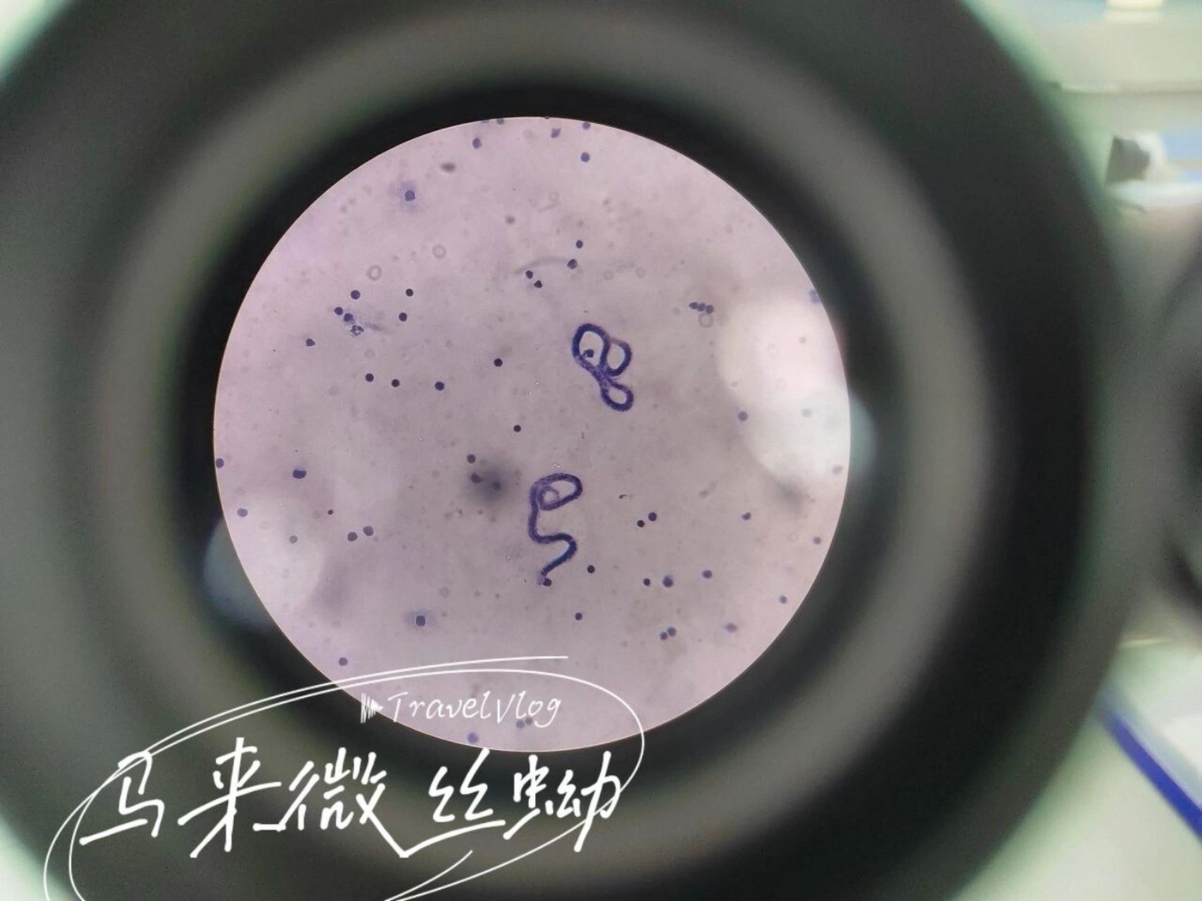 寄生虫—班氏,马来微丝蚴,广州管圆线虫 今天观察了 7015班氏丝状