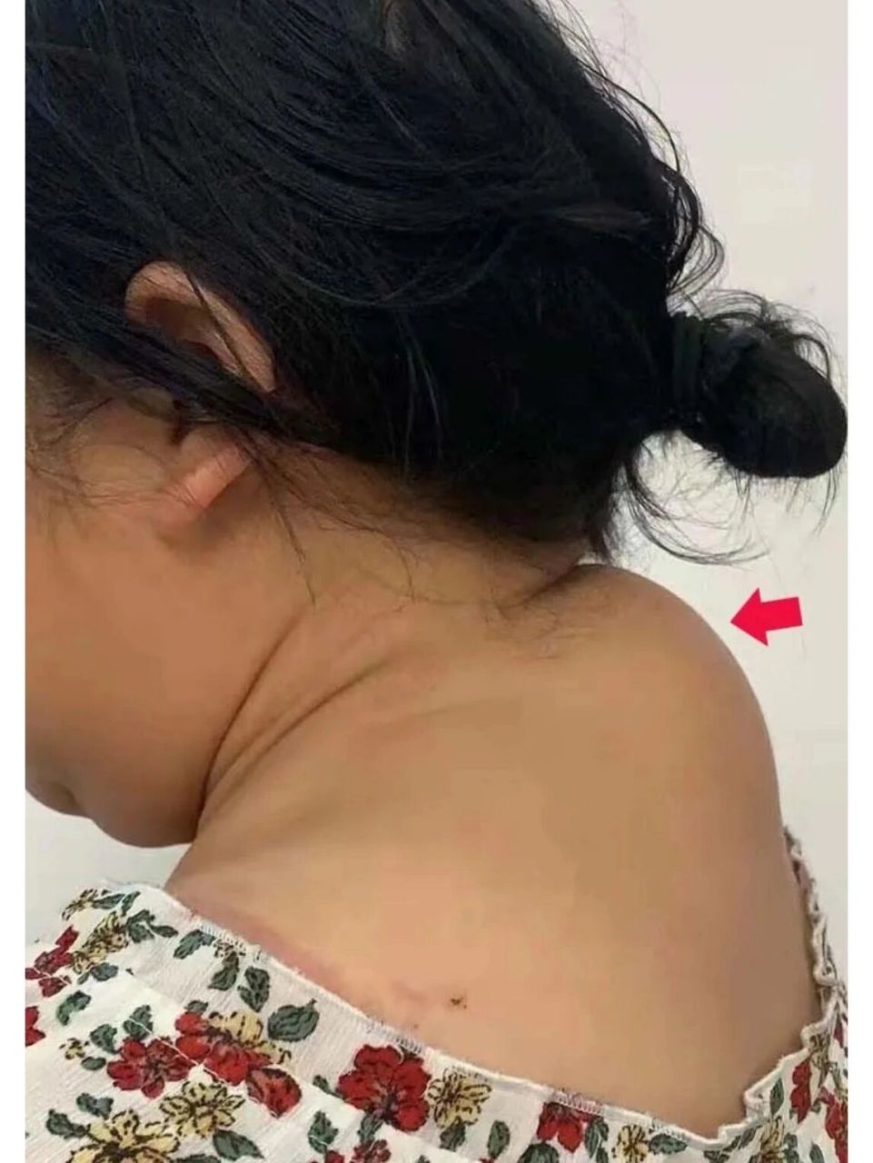 "富贵包"的真相与治疗措施 "富贵包"这个词常出现