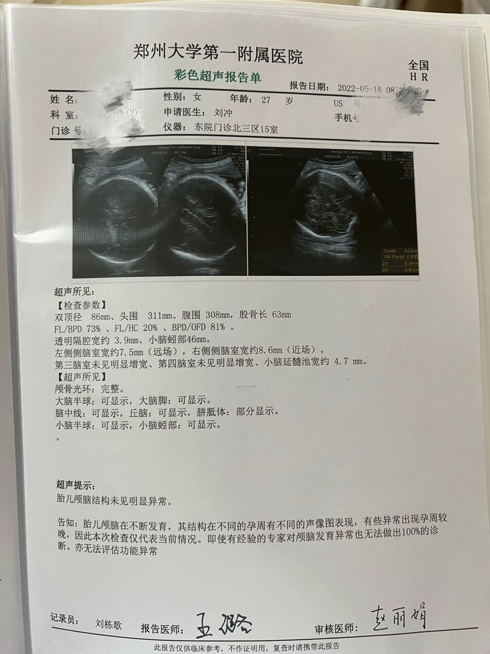 胎儿颅脑彩超顺利通过~ 小排畸的时候侧脑室临界值,医生建议34周再