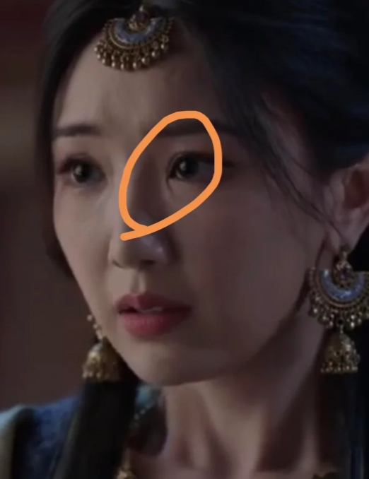 粉丝勿骂她的眼部赘皮让我好出戏,看着有点奇怪,甚至很多人说她开眼角