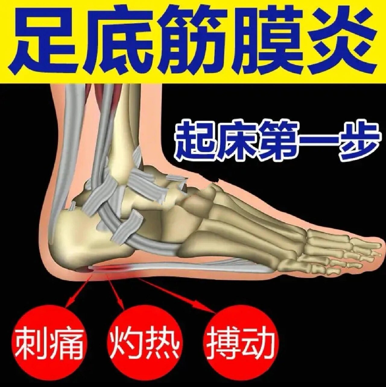 筋膜炎疼痛位置图片图片