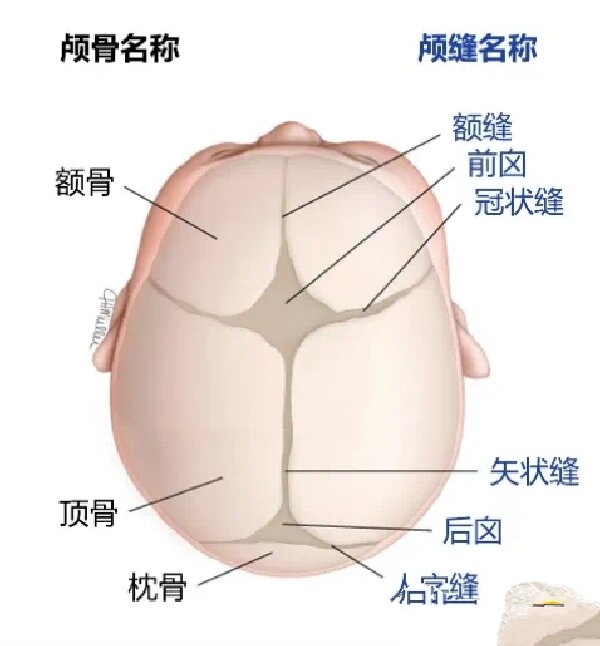 好多妈妈咨询颅缝早闭头型症状顺便科普一下 颅缝早闭的临床表现 主要