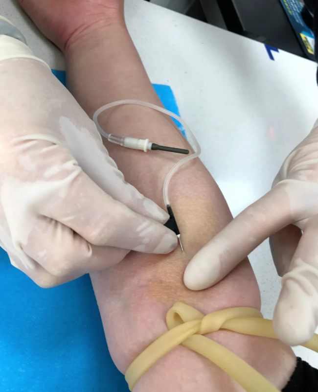 怀孕一个月没任何反应可能是正常的,也可能是胚胎停止发育导致的