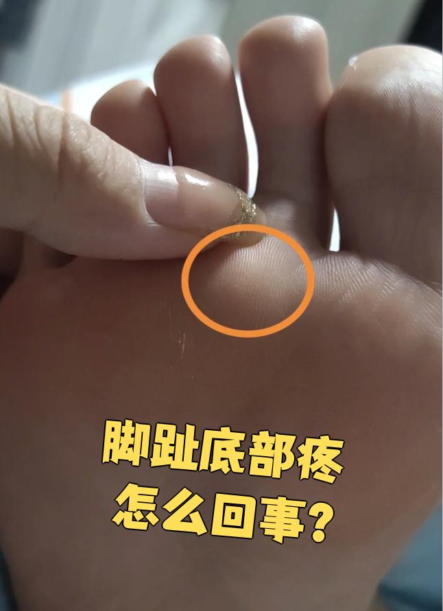 为什么脚底板疼