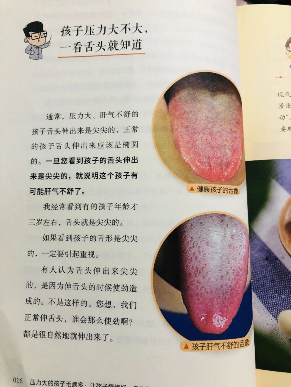 肝气不舒的孩子舌头表现 一旦看到孩子的舌头伸出来是尖尖的,说明肝气