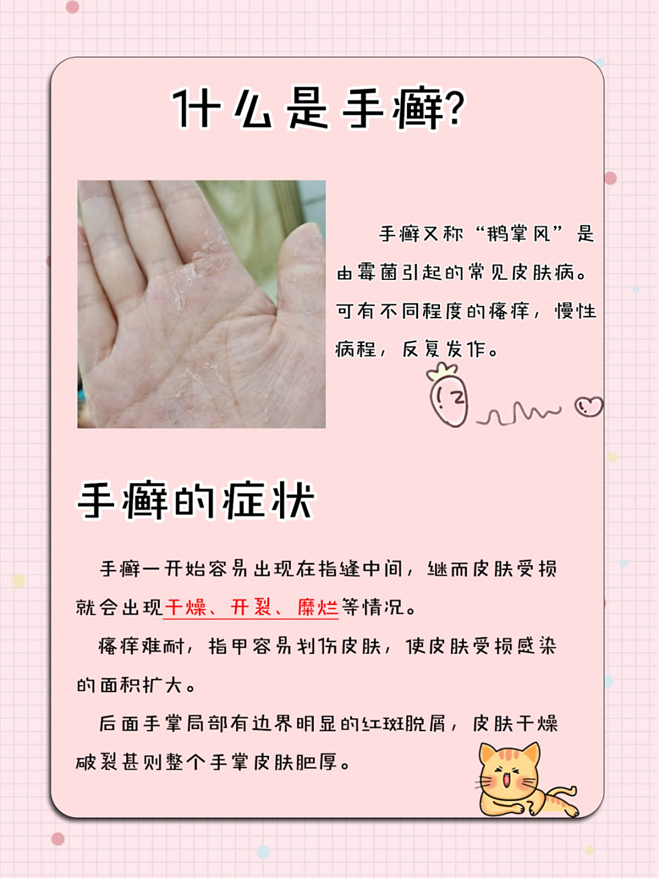 手癣应该怎么治?我来告诉你,亲身体验! 手藓是怎么来的?