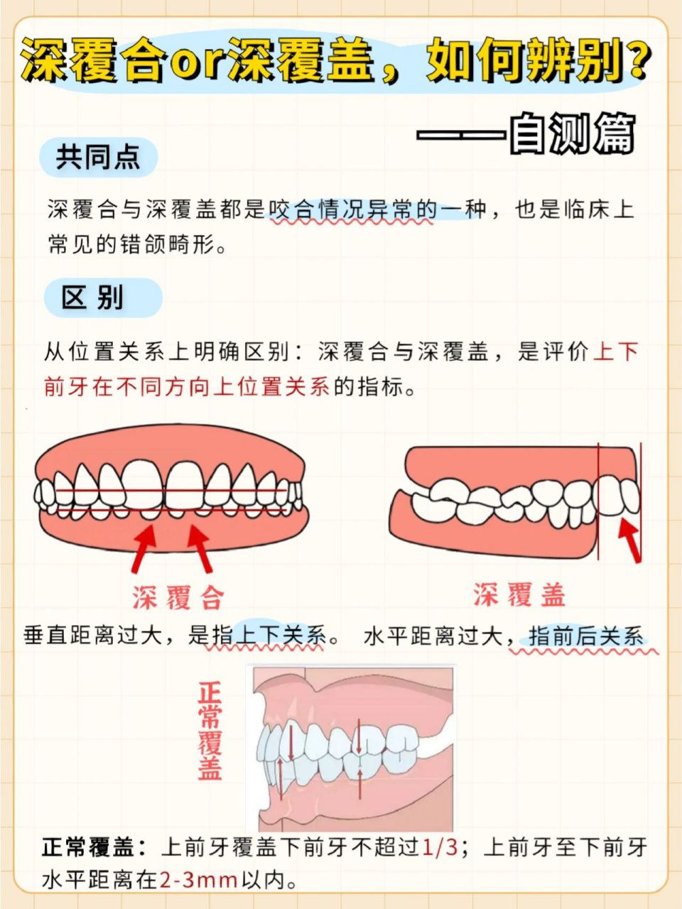 深覆合和深覆盖区别图片