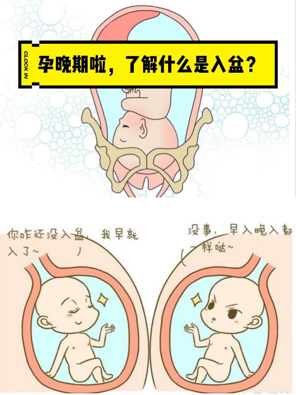 孕期常识 | 什么是入盆?