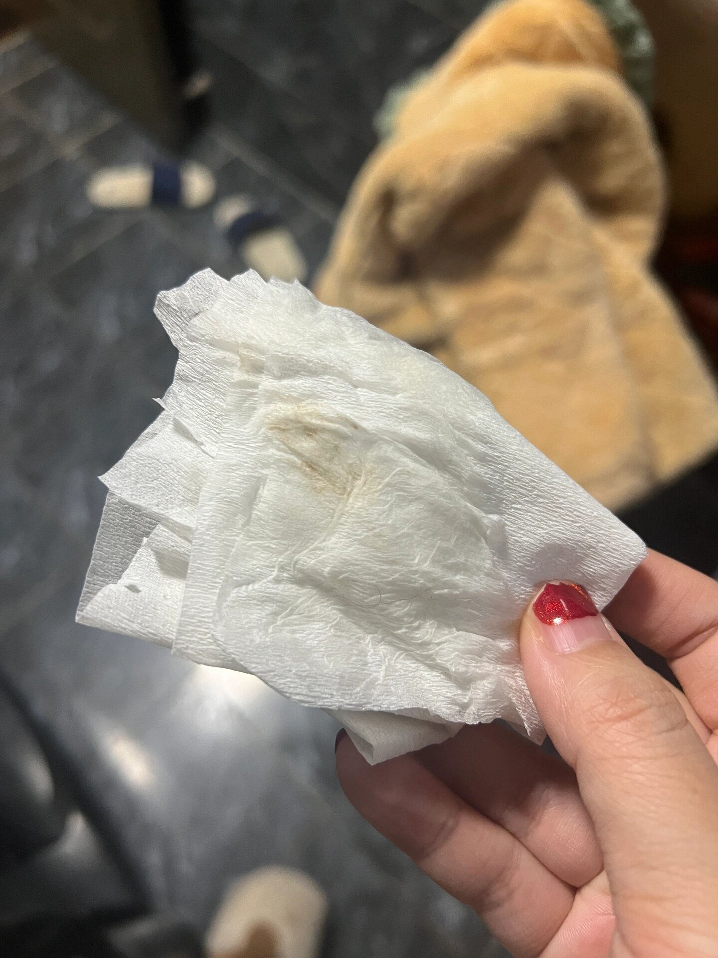 怀孕六周褐色分泌物