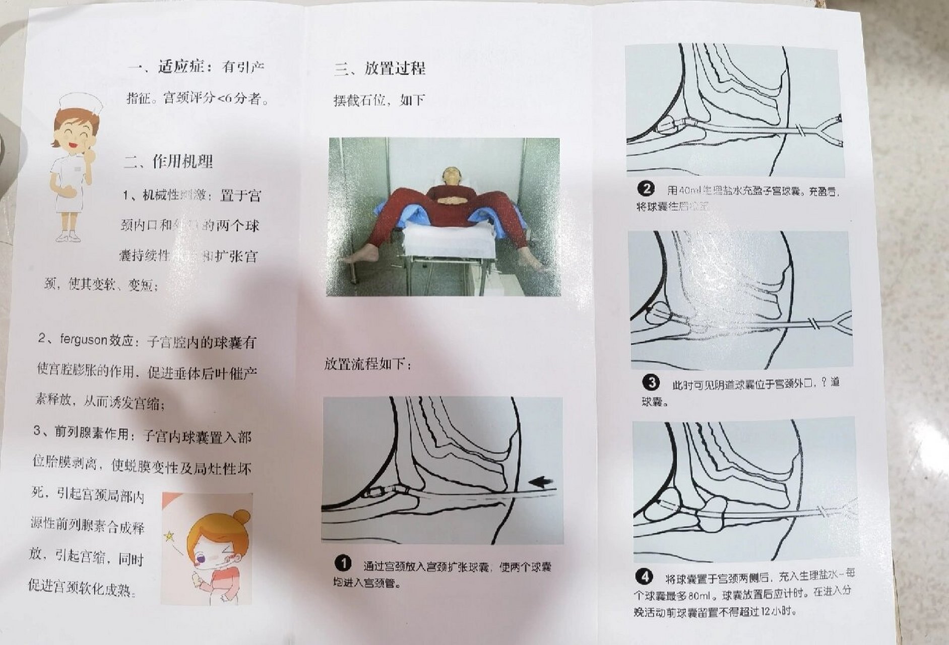 分娩球的正确使用方法图片