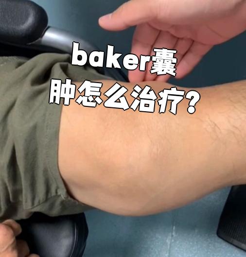 是长在膝关节后面的囊性肿块,通常需要术术