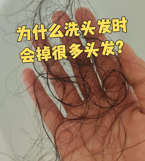 为什么洗头发时会掉很多头发,吹干了就不掉了为什么在线 为什么洗头发时会掉很多头发,吹干了就不掉了为什么在线
