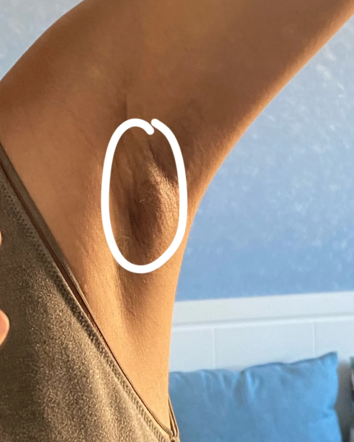 胳肢窝长了一个硬块很痛怎么回事?该怎么办?