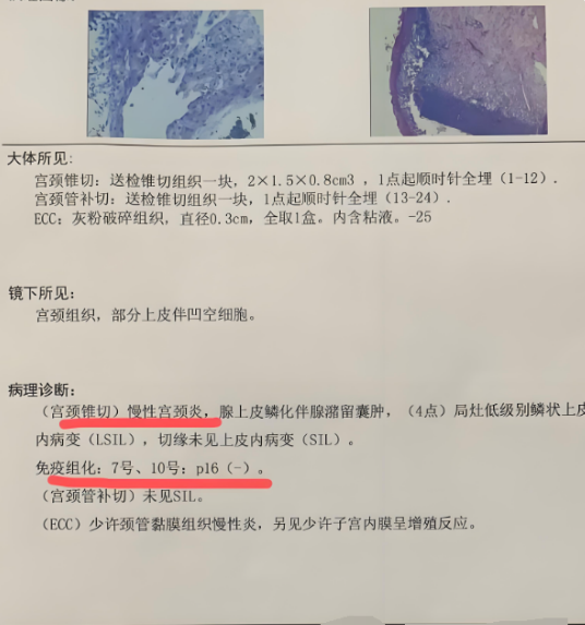 正常情况下,宫颈黏液是白色或透明的,像蛋清一样,可能带一点腥味 