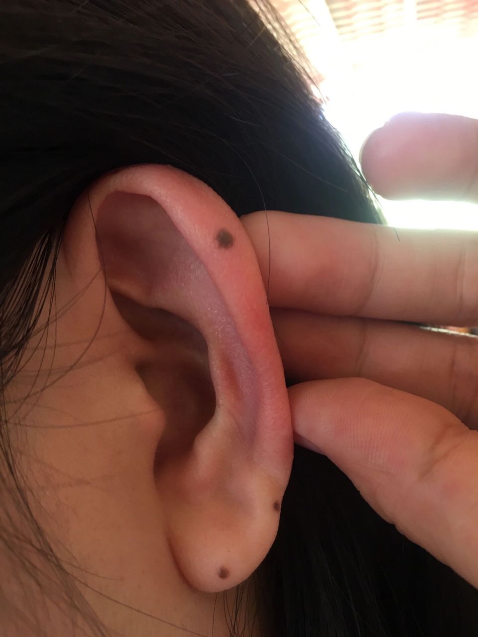 耳朵上的痣 不去洗脸不知道耳朵上还有几个痣,说我的痣长的位置都挺好