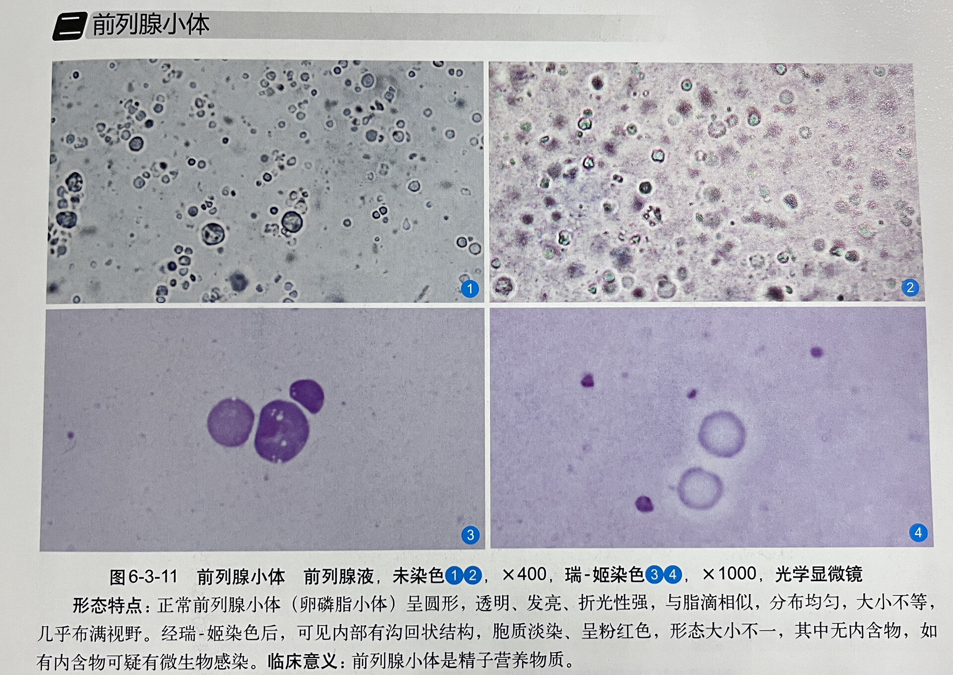 前列腺镜下图片图片