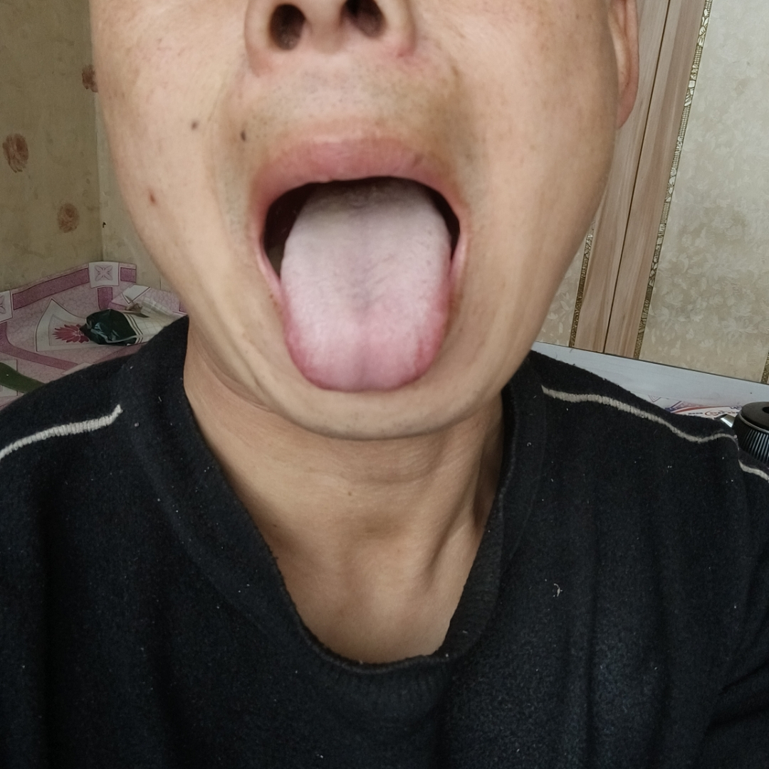 齿痕舌，肝郁脾虚了万病来找，中医教你一招，疏肝健脾，消万病