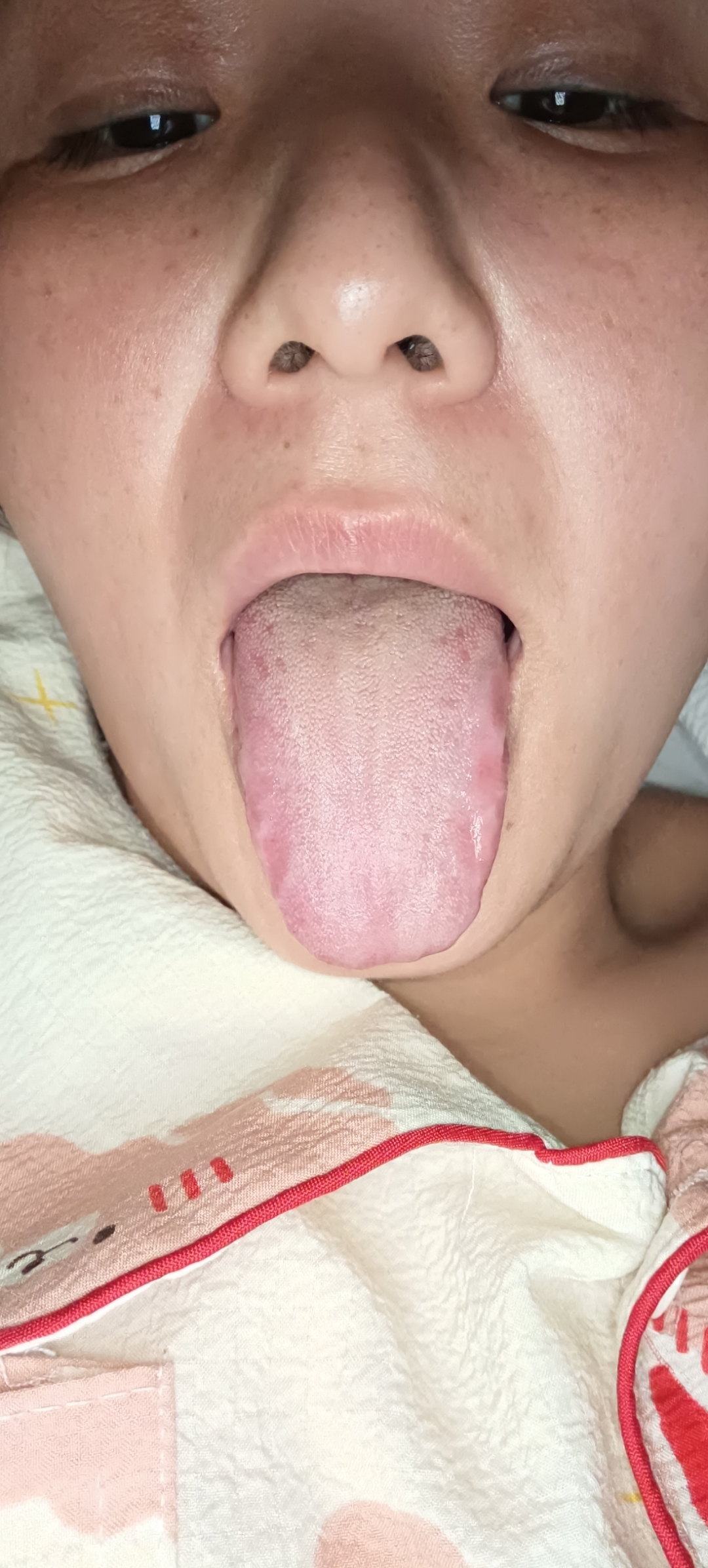 齿痕舌，肝郁脾虚了万病来找，中医教你一招，疏肝健脾，消万病