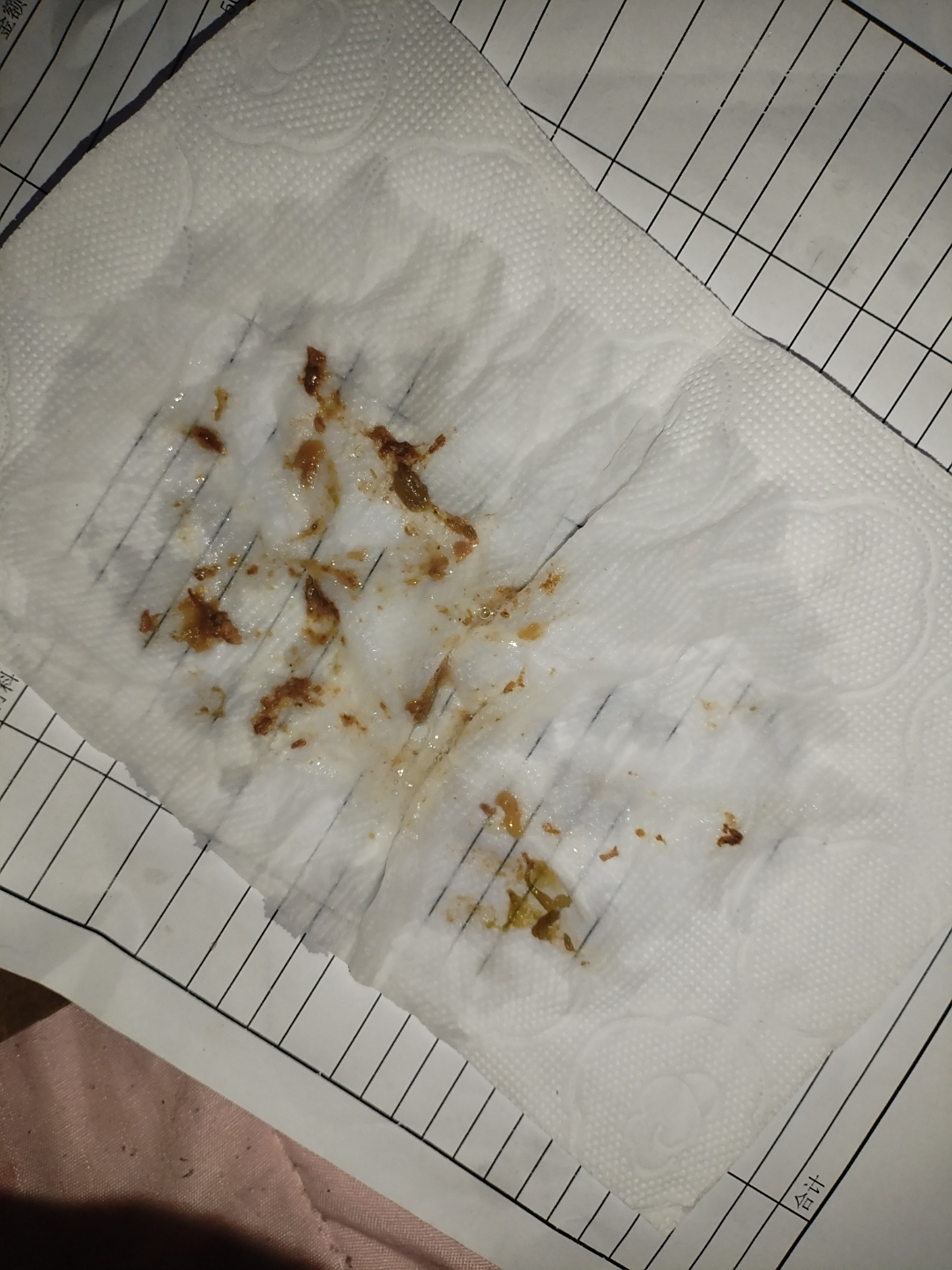 9种颜色痰液自检🧐不同痰颜色代表什么
