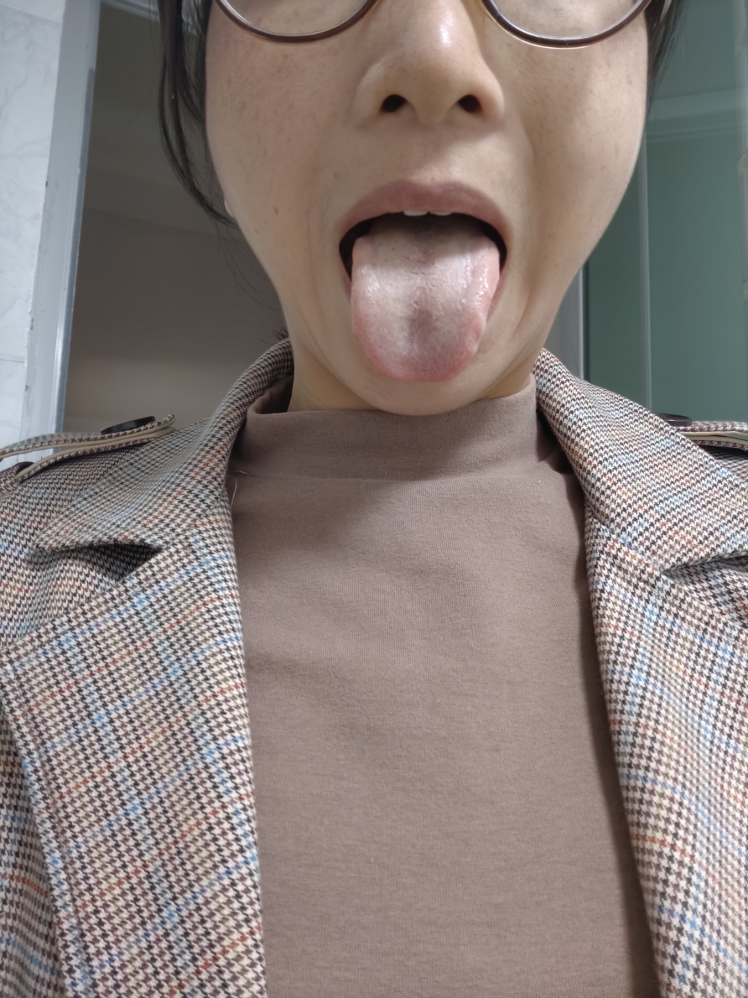 这种舌头还去湿热简直是胡来！不是所有的发黄都是湿热化火